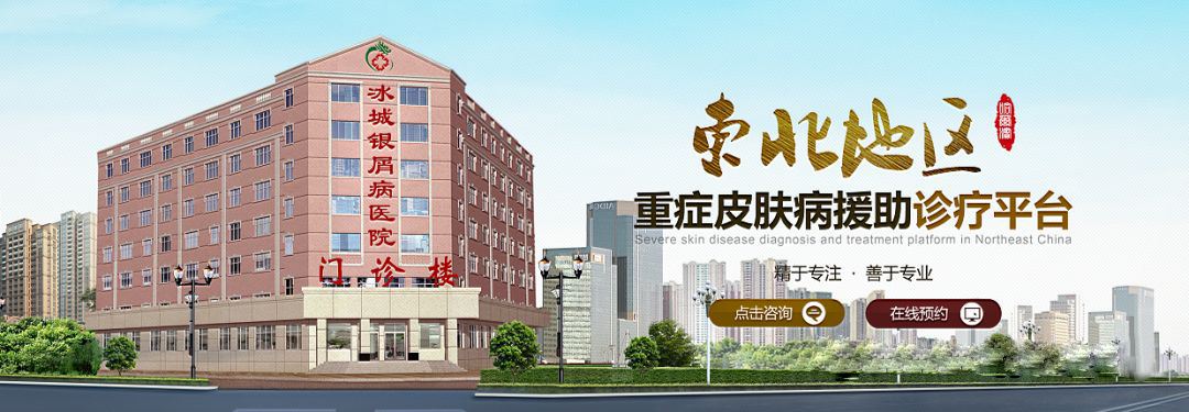 上海银屑病专科医院(上海银屑病的专业医院)
