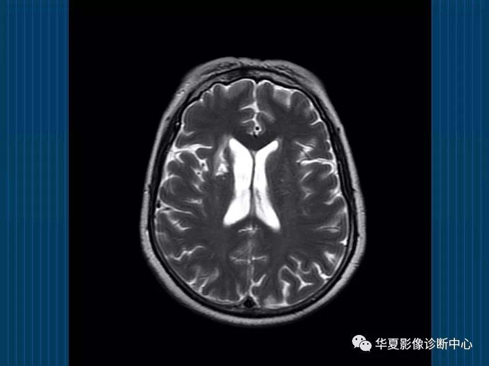 北京大学第六医院【贾美香-刘靖-孙黎】号贩子代挂号；一文看懂X线、CT与核磁(MRI)的区别的简单介绍