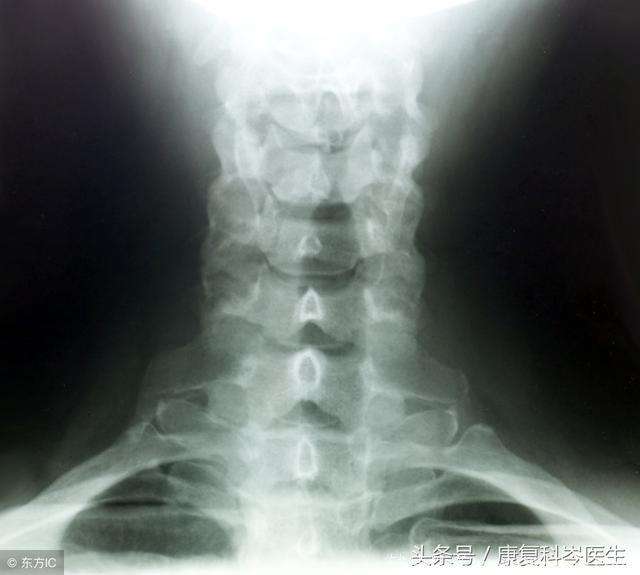 积水潭医院骨科黄牛挂号就是靠谱；X光片、CT、核磁有什么区别?看病用哪个好?一个比喻你就明白了的简单介绍