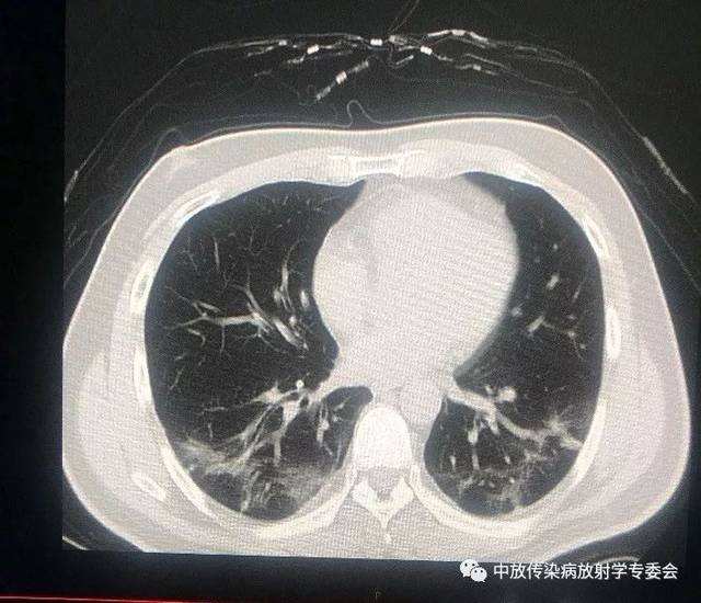 关于北京市海淀医院号贩子陪诊挂号；X光片、CT、核磁有什么区别?看病用哪个好?一个比喻你就明白了的信息
