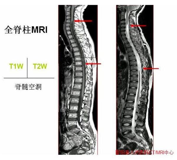 307医院挂号最靠谱的黄牛秒出号；「科普」常用的影像学检查——核磁共振(MRI)的简单介绍