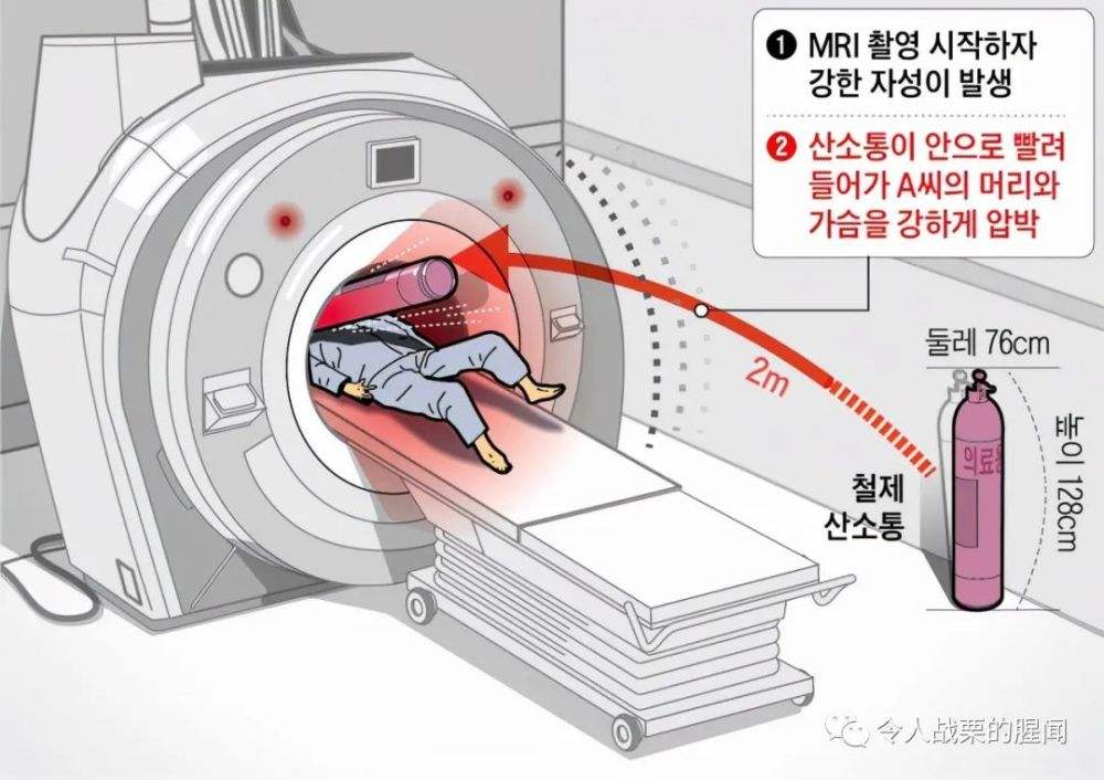回龙观医院黄牛建档专家挂号都可以；「科普」常用的影像学检查——核磁共振(MRI)的简单介绍