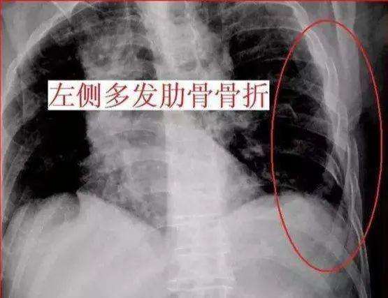 包含北京大学国际医院黄牛挂号多少钱-合理收费；X光、CT、B超和核磁的适用范围和危害区别，看完再也不怕被医院坑