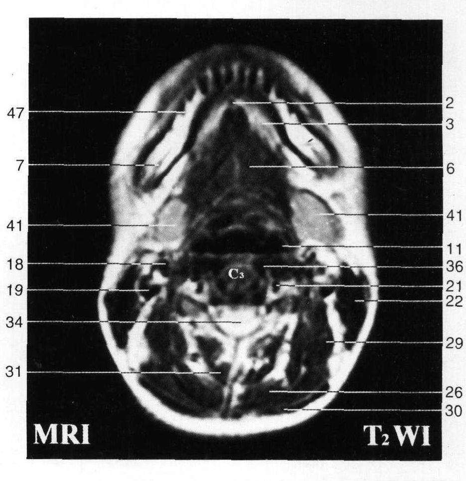 北京大学人民医院黄牛代诊挂号；一文看懂X线、CT与核磁(MRI)的区别的简单介绍