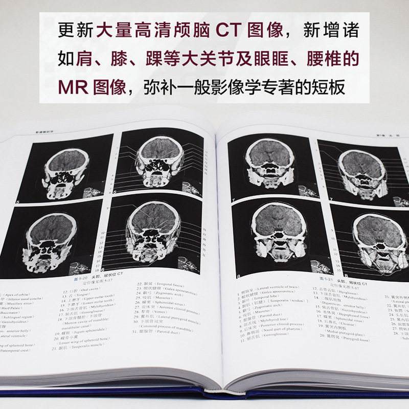 关于空军特色医学中心正骨皮肤黄牛挂号随时接单；一文看懂X线、CT与核磁(MRI)的区别的信息