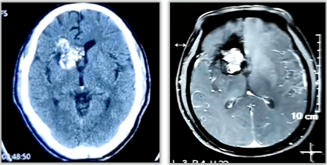 关于西苑医院号贩子代挂怎么联系；「科普」常用的影像学检查——核磁共振(MRI)的信息