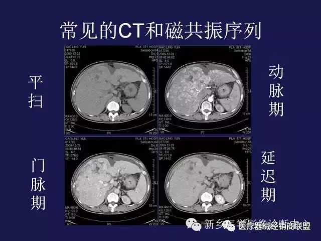 北京大学国际医院产科代挂黄牛电话；一分钟看懂，什么是X线、CT、核磁?的简单介绍