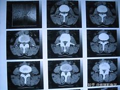 北京大学国际医院产科代挂黄牛电话；X光、CT、B超和核磁的适用范围和危害区别，看完再也不怕被医院坑的简单介绍