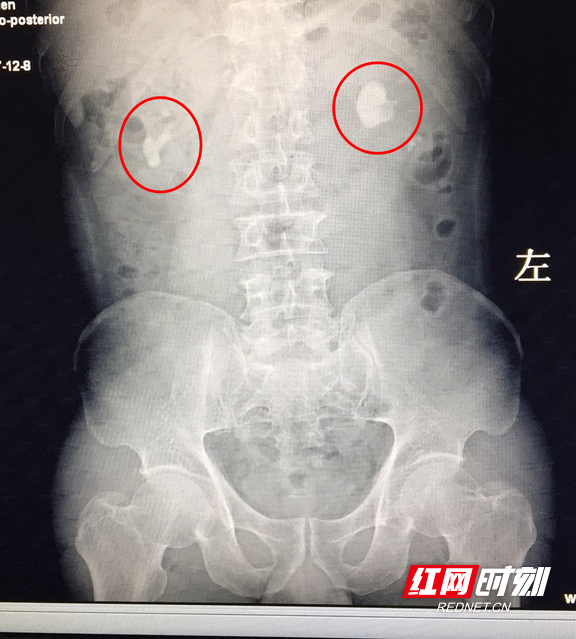 关于北医六院找黄牛买郭延庆的号简直太方便了；X线、CT、B超、核磁哪个辐射大?你绝对想不到!的信息
