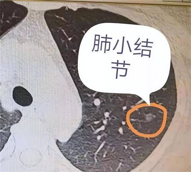包含北京儿童医院代挂陪诊服务；X线、CT、核磁、B超到底有什么区别和缺点?这可能是最详细的了