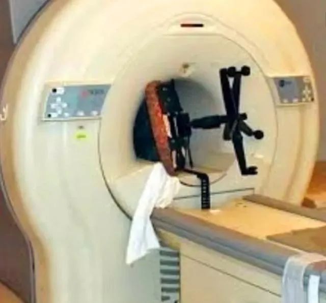 包含西苑医院号贩子一手挂号就是快；大夫，听说放射检查有射线!MRI，就是磁共振，安全吗?
