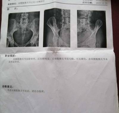 北京市海淀妇幼保健院黄牛建档挂号；X光片、CT、核磁有什么区别?看病用哪个好?一个比喻你就明白了的简单介绍