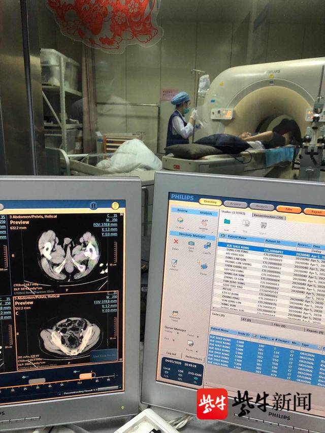 东直门医院【李忠】代挂黄牛电话；CT和核磁共振有何区别?为何检查肺常做CT，头颅常做磁共振?的简单介绍