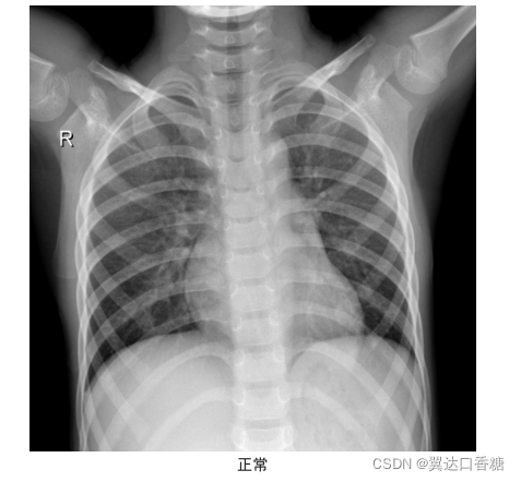 朝阳医院呼吸科专家找黄牛代挂每天都有号；一分钟看懂，什么是X线、CT、核磁?的简单介绍
