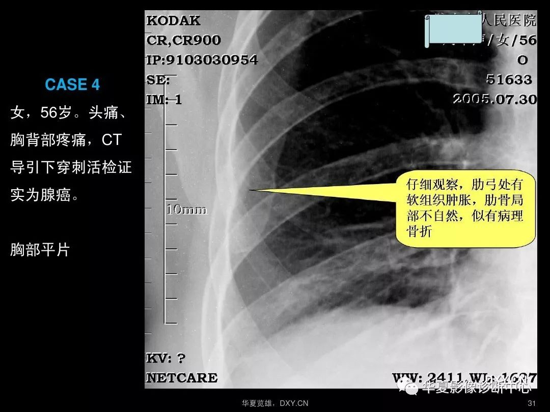 北京中医药大学第三附属医院跑腿代挂联系电话；X线、CT、核磁的区别，看完一点不懵了的简单介绍