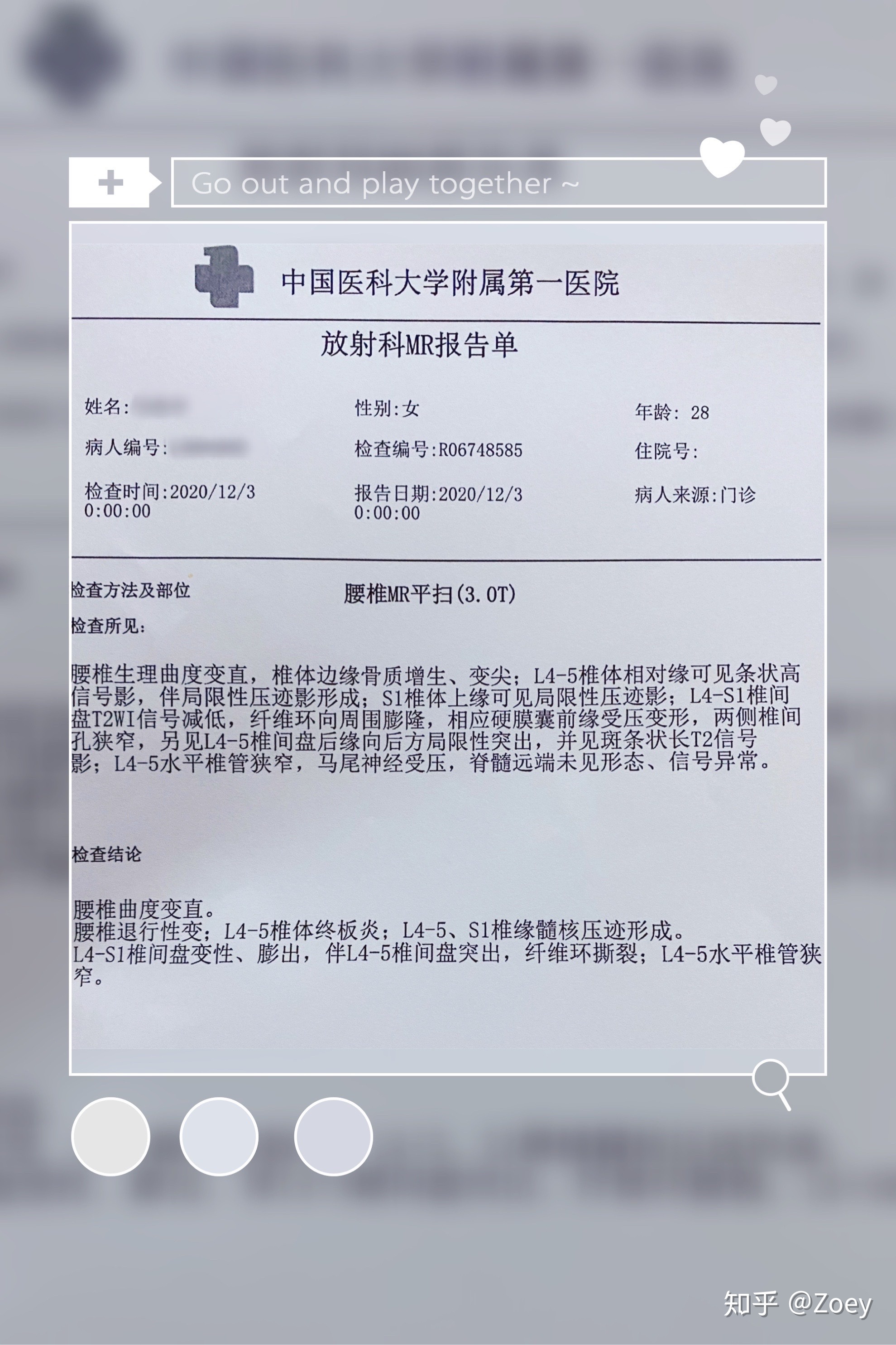 北医六院找黄牛买郭延庆的号简直太方便了；拍核磁，究竟拍的是什么?的简单介绍