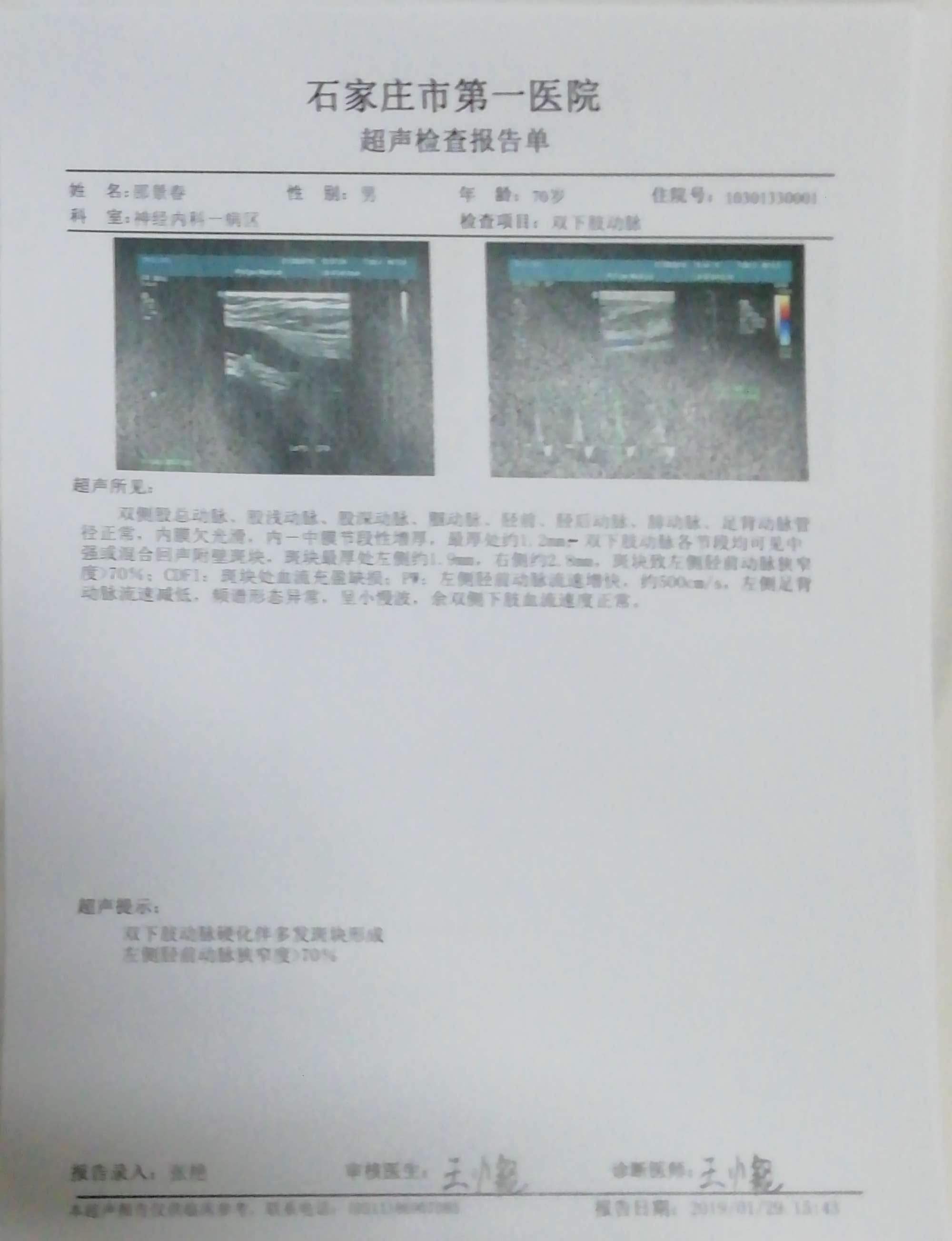 安贞医院黄牛挂号京事通关节炎为什么拍完X光片还需要做超声、核磁?的简单介绍