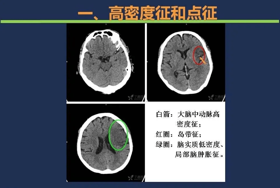 关于北京儿研所号贩子代挂陪诊就医；一文看懂X线、CT与核磁(MRI)的区别的信息