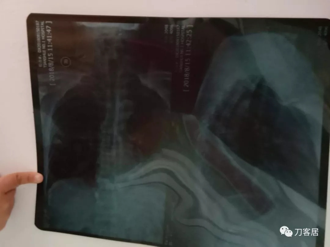 关于北医六院找黄牛买郭延庆的号简直太方便了；一分钟看懂，什么是X线、CT、核磁?的信息