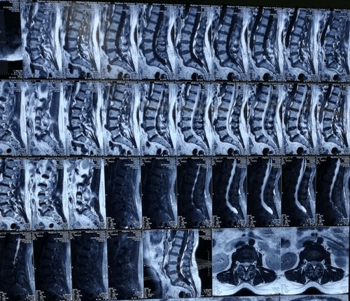 武警总医院跑腿挂号代办；常见的影像学检查，X线、CT、核磁、B超到底有什么区别?的简单介绍