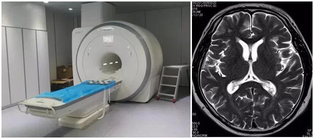 关于海军总医院号贩子挂号推荐；大夫，听说放射检查有射线!MRI，就是磁共振，安全吗?的信息