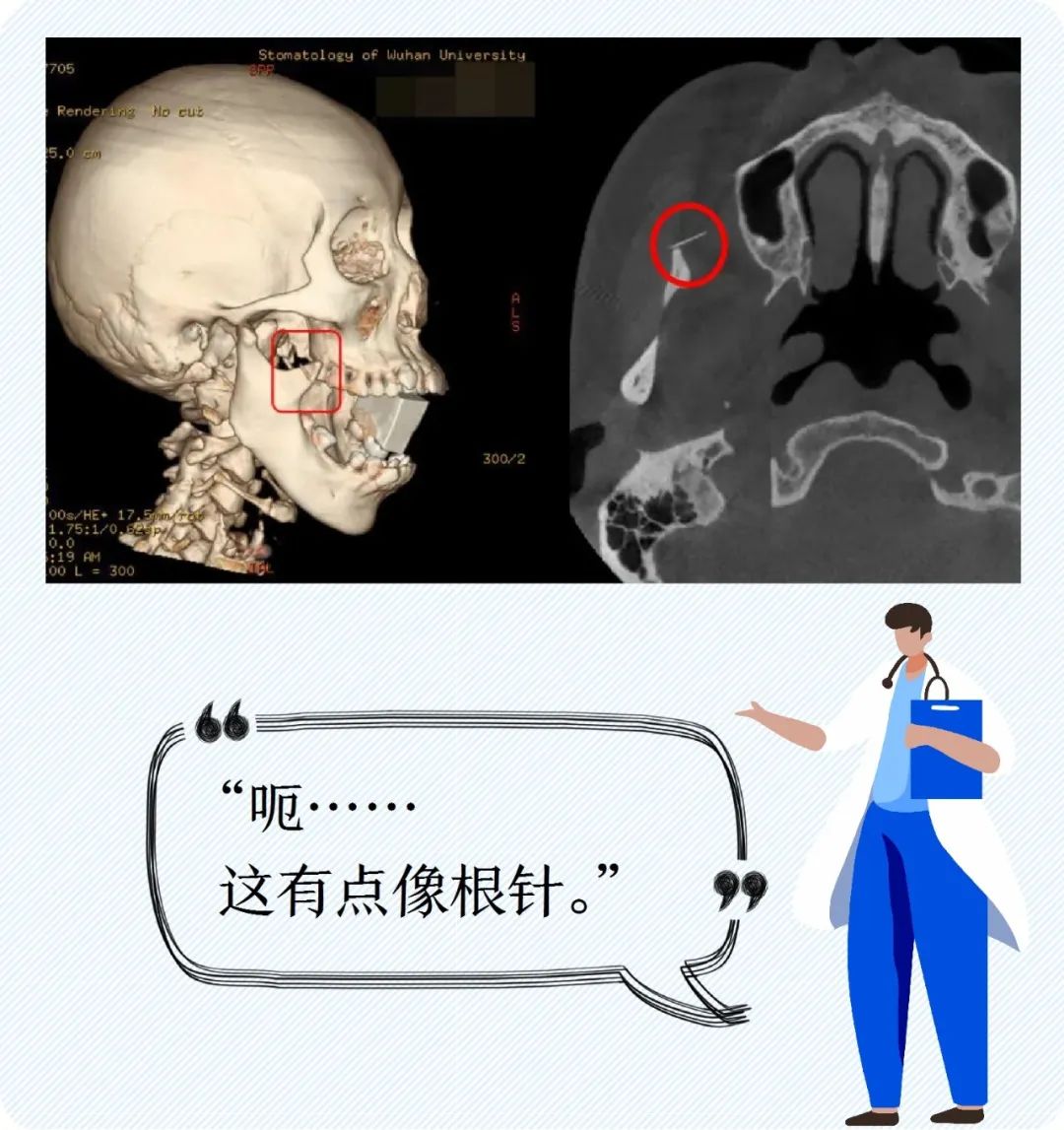 关于北京儿研所号贩子代挂陪诊就医；X线、CT、B超、核磁哪个辐射大?你绝对想不到!的信息