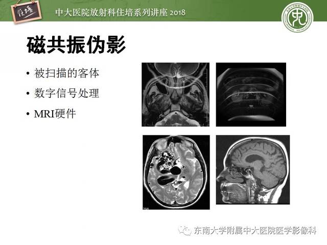 包含北京大学口腔医院牙体牙髓黄牛代挂多少钱；磁共振成像清晰还没有辐射，为什么还不能取代CT?