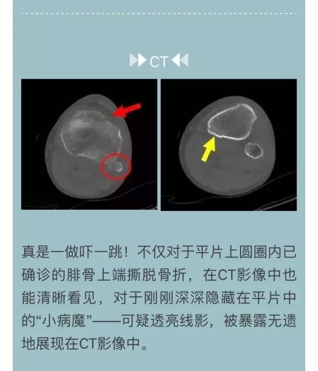 关于阜外医院知名专家黄牛快速挂号；CT、B超和核磁之间有什么区别?这篇文章给你科普一下的信息