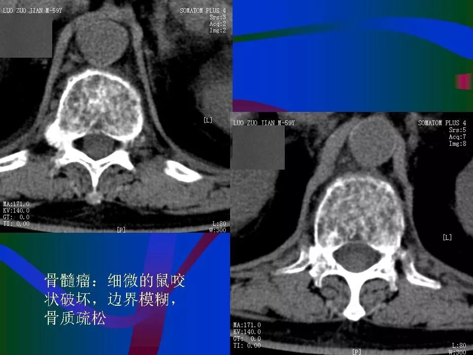 北医六院找黄牛买郭延庆的号简直太方便了；一文看懂X线、CT与核磁(MRI)的区别的简单介绍