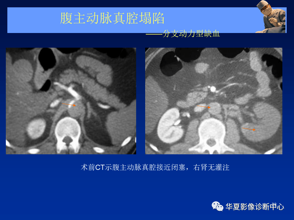 首都医科大学附属安贞医院心血管专家黄牛代挂；一文看懂X线、CT与核磁(MRI)的区别的简单介绍