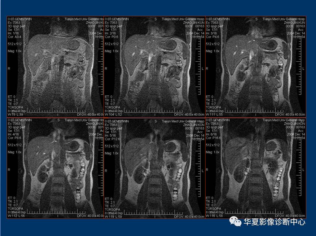 地坛医院【刘彦春】黄牛，号贩子随时出号；大夫，听说放射检查有射线!MRI，就是磁共振，安全吗?的简单介绍
