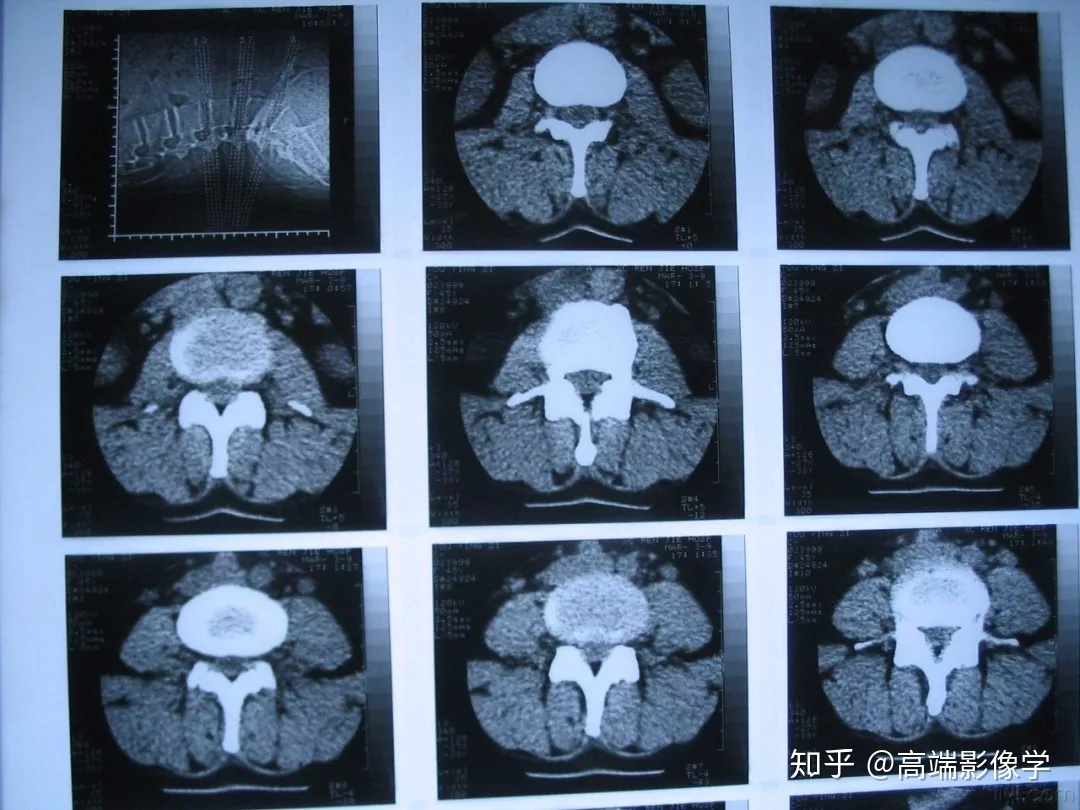 关于安贞医院黄牛挂号京事通DR(X线)、CT、核磁(MRI)到底有什么区别?的信息