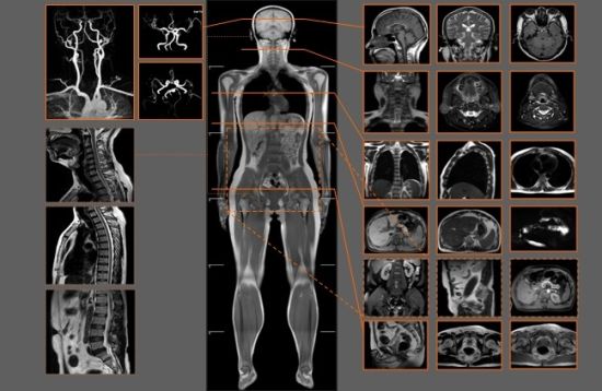 博爱医院黄牛帮你解决挂号难题；肿瘤诊断之磁共振成像(MRI)检查的简单介绍
