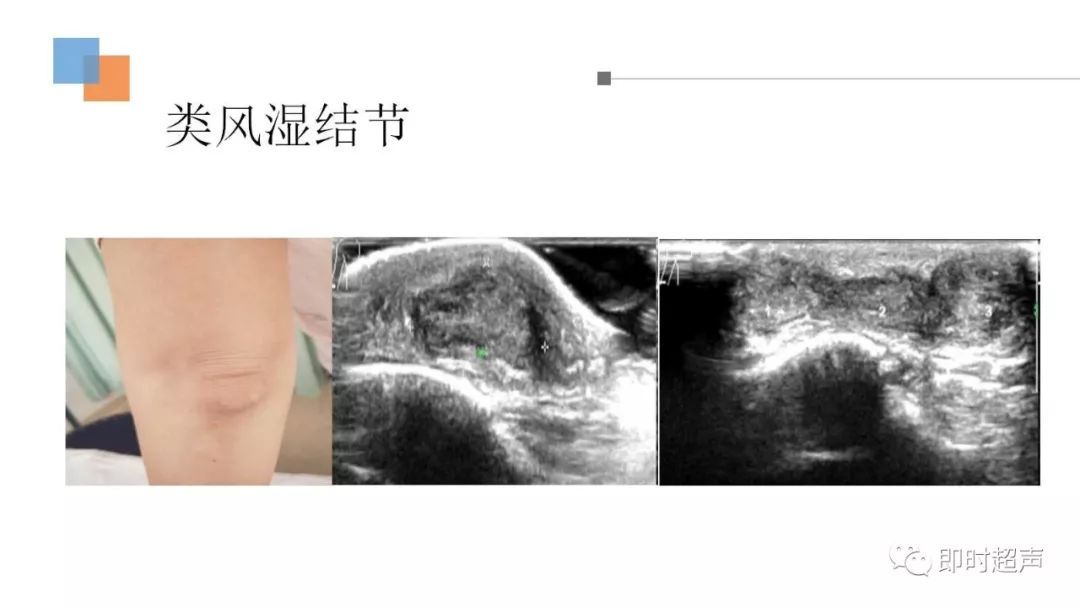 北京中医药大学第三附属医院跑腿代挂联系电话；关节炎为什么拍完X光片还需要做超声、核磁?的简单介绍